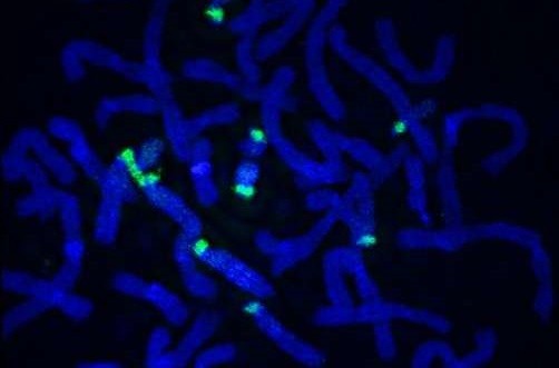 Хромосомы человека окрашиваются в синий цвет с рибосомной ДНК в зеленый цвет.