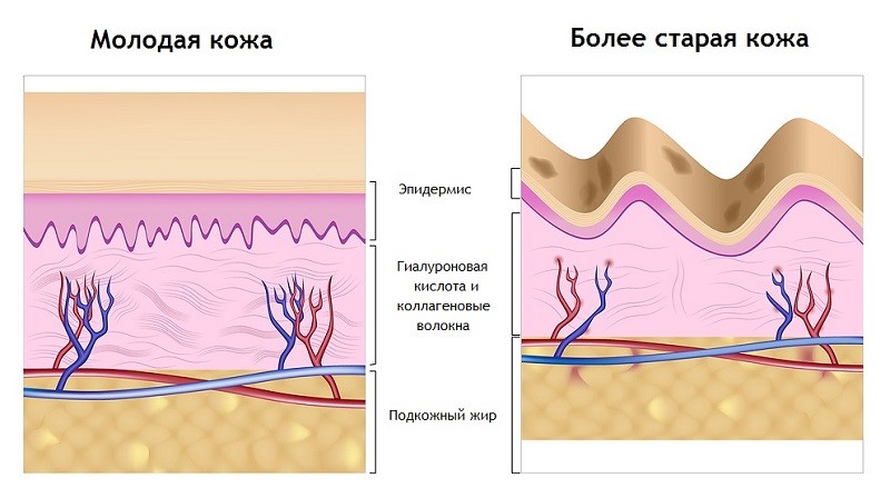 Гиалуроновая кислота и коллагеновые волокна