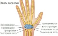 Болит косточка на запястье левой руки причины