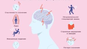 Приступ эпилепсии - симптомы и признаки
