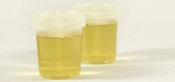 Ацетон в моче – причины, симптомы, лечение у ребенка и у взрослых виды ...